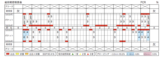 歯周ポケットの再測定